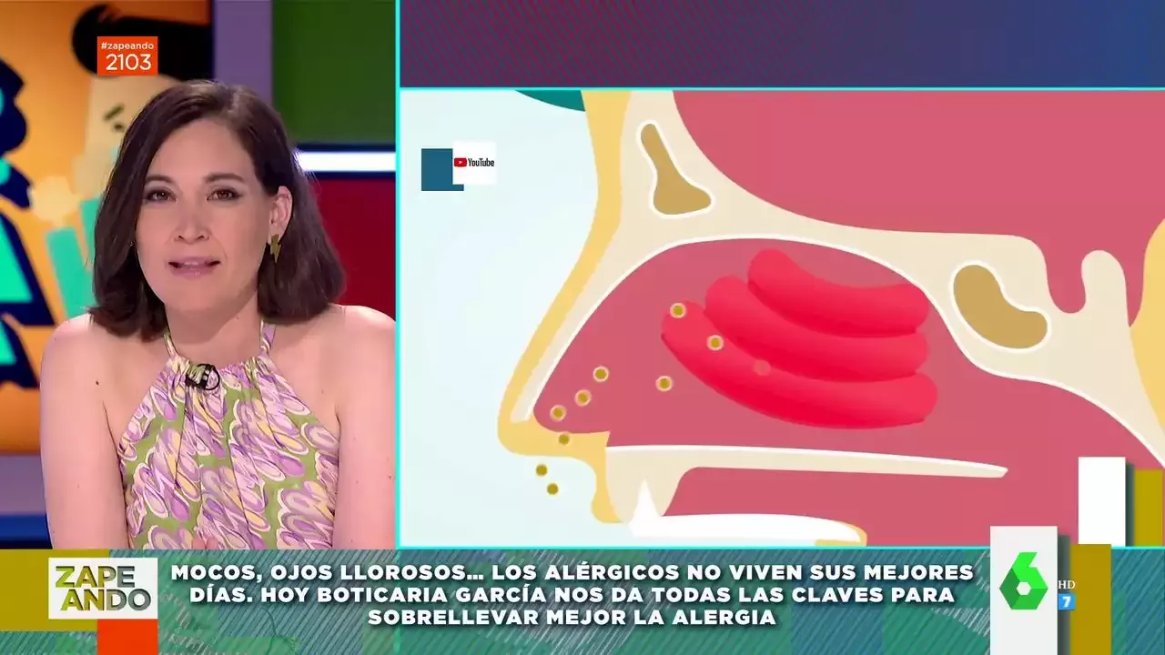 Qué es la poliposis nasal Boticaria García explica sus síntomas