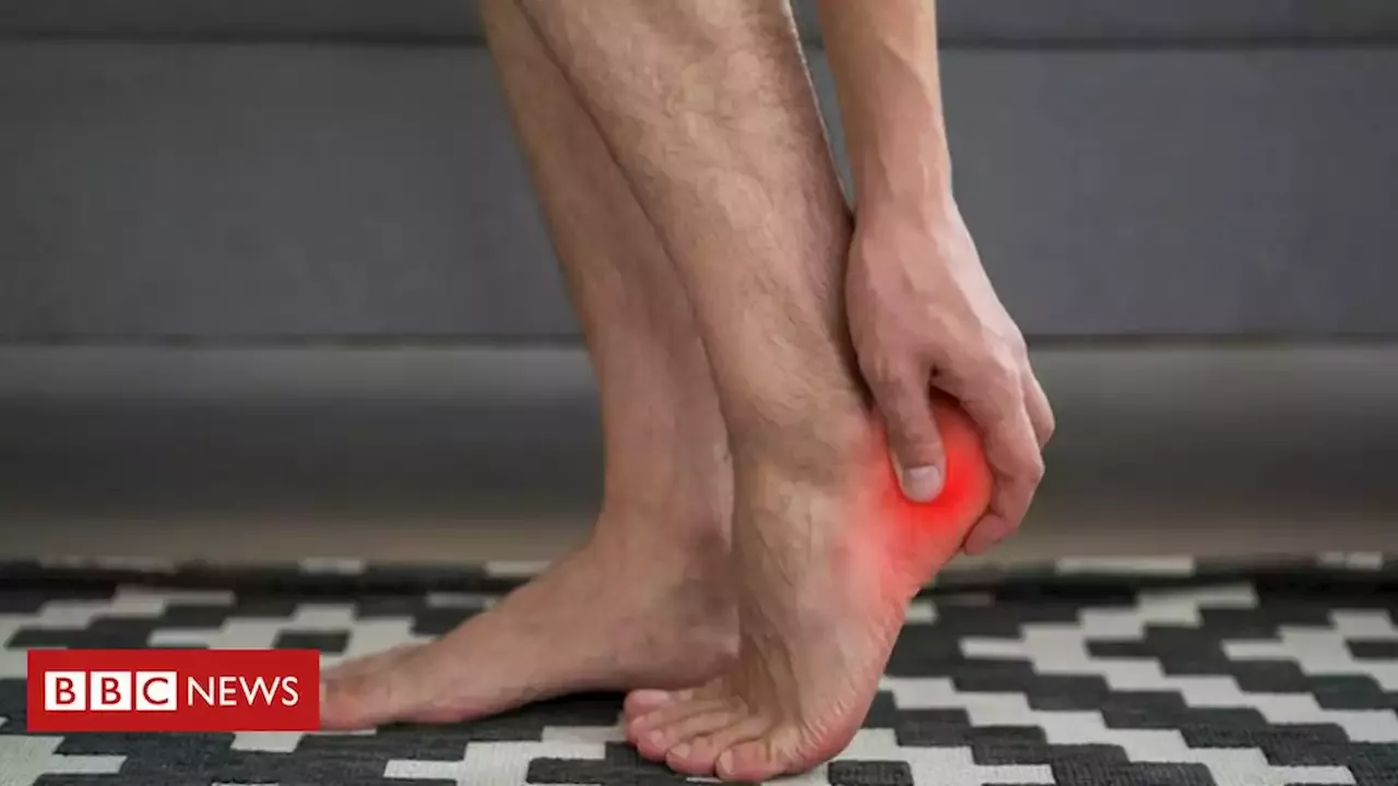 Fascite plantar como tratar dor na sola do pé BBC News Brasil Brasil