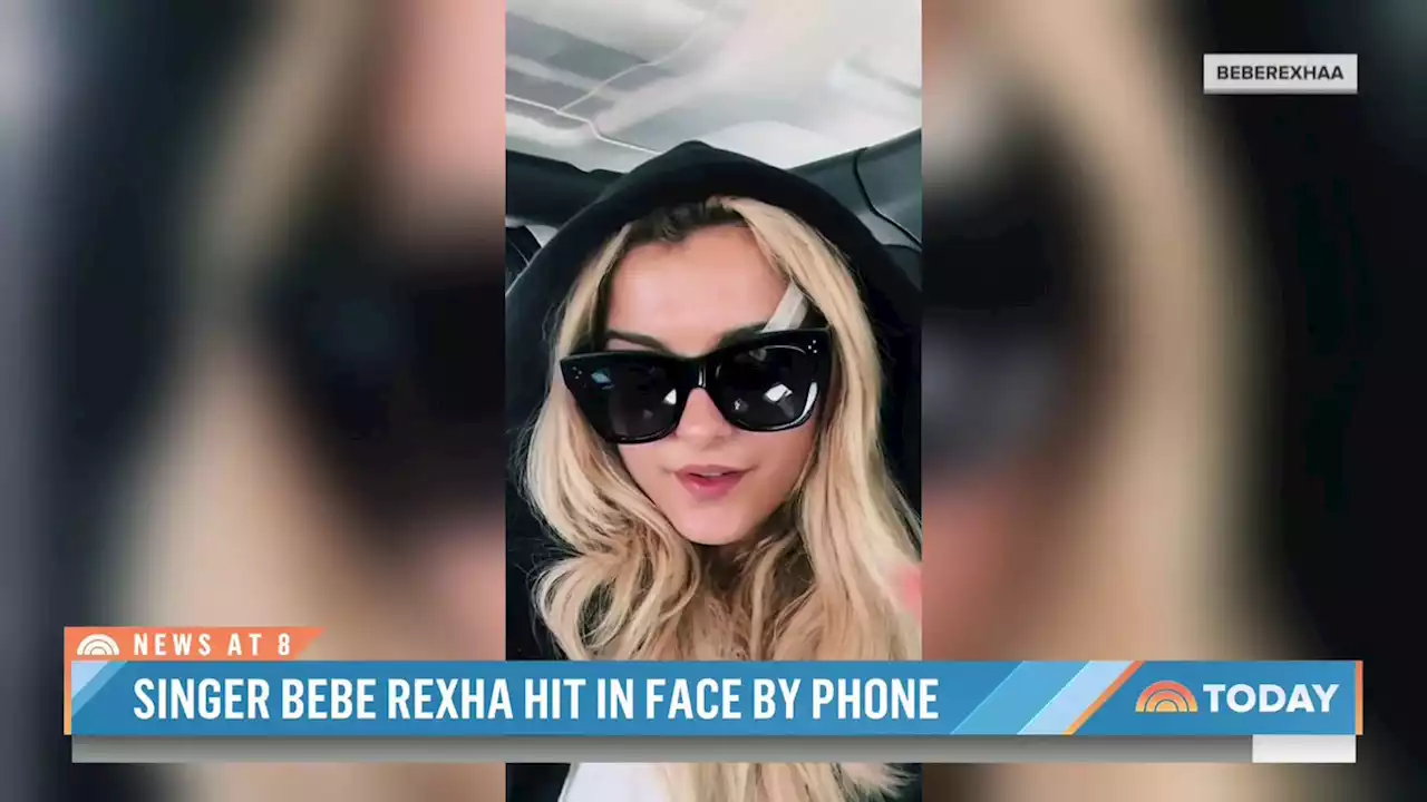 Bebe Rexha Shares New Photos Of Injuries After Getting Hit In Face By