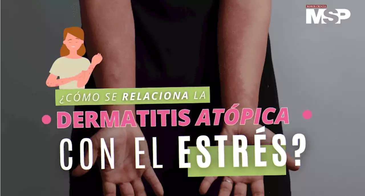 Cómo se relaciona la dermatitis atópica con el estrés