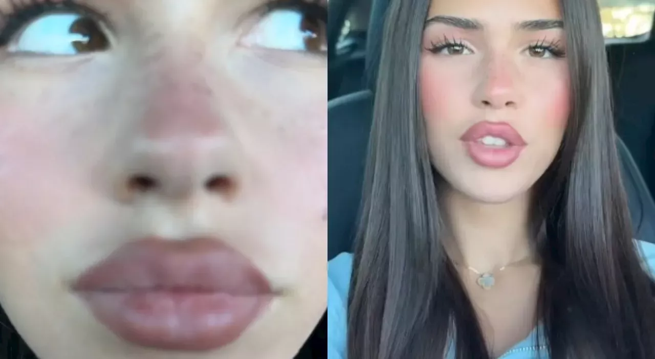 Tik Tok Visualizzazioni Leah Halton Il Video Su Tik Tok Che Batte