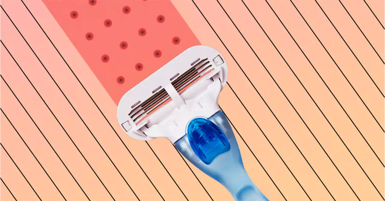 The Ugly Truth About Ingrown Hairs (& How to Deal with Them ASAP)