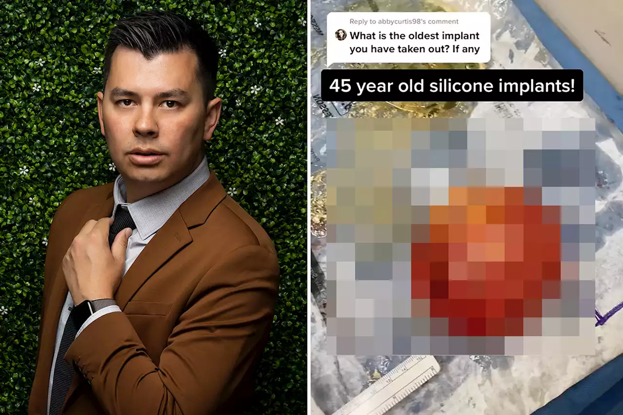 Plastic surgeon reveals the weirdest, most fascinating things he’s ever seen