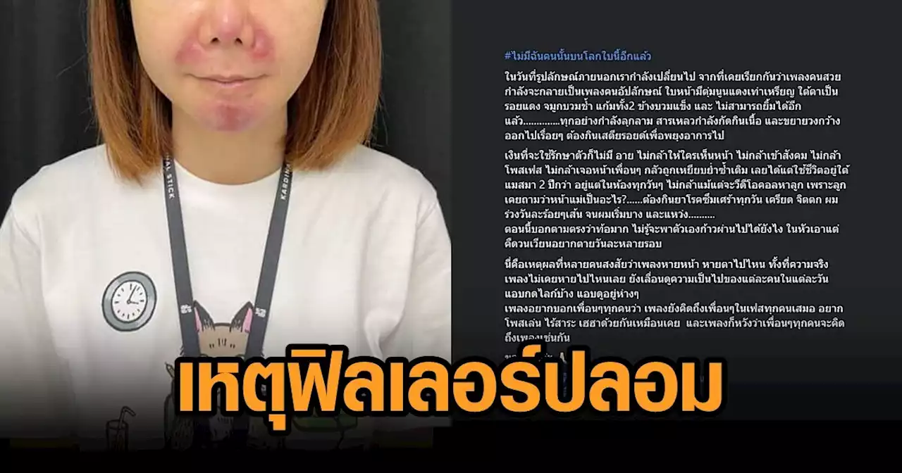 สาววอนพลังโซเชียล คลินิกดังใช้ฟิลเลอร์ปลอม ทำใบหน้า-จิตใจเสียหาย แถมขู่ให้ลบโพสต์
