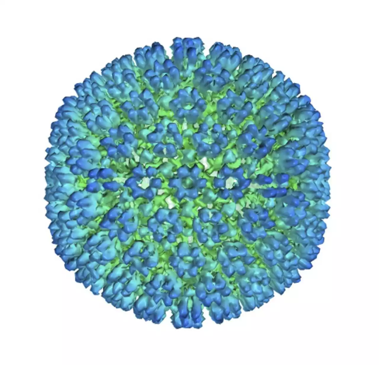 Multiple sclerosis could be triggered by Epstein-Barr virus, study suggests
