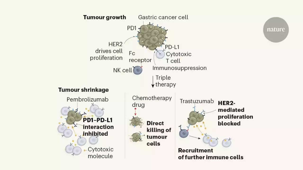 Stomach cancer gets a triple punch of therapy