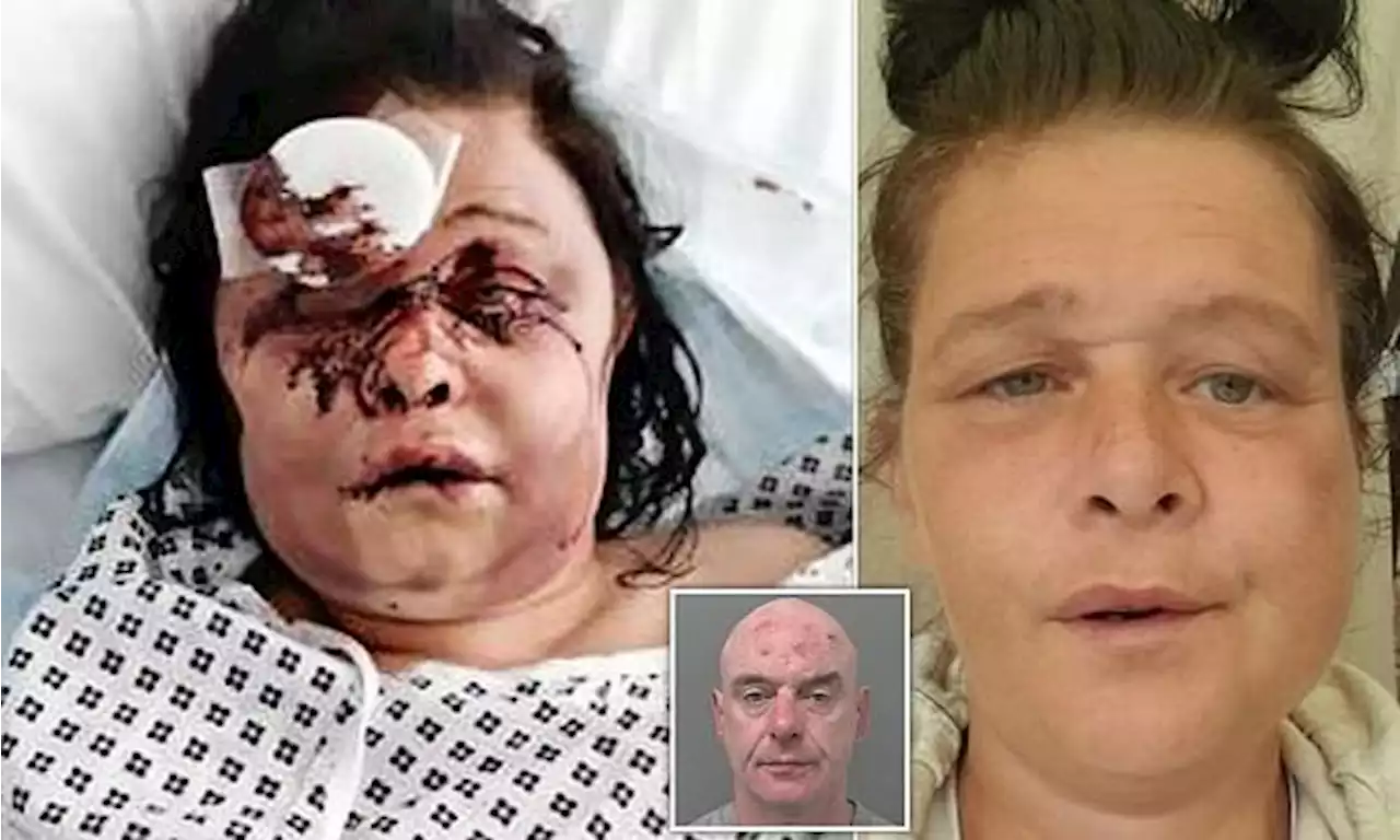 Boyfriend beat domestic abuse survivor, 40, leaving her unrecognisable