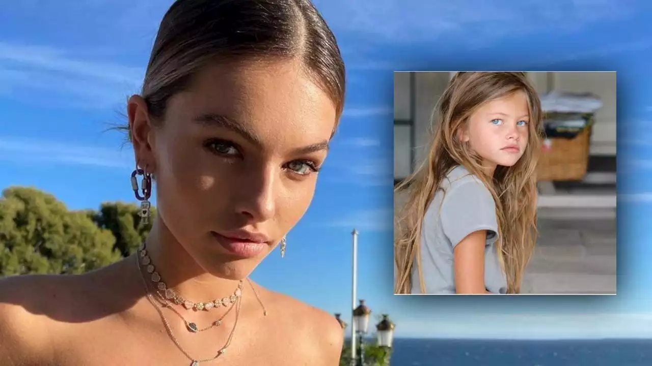 Thylane Blondeau (20) - Not-OP beim schönsten Mädchen der Welt