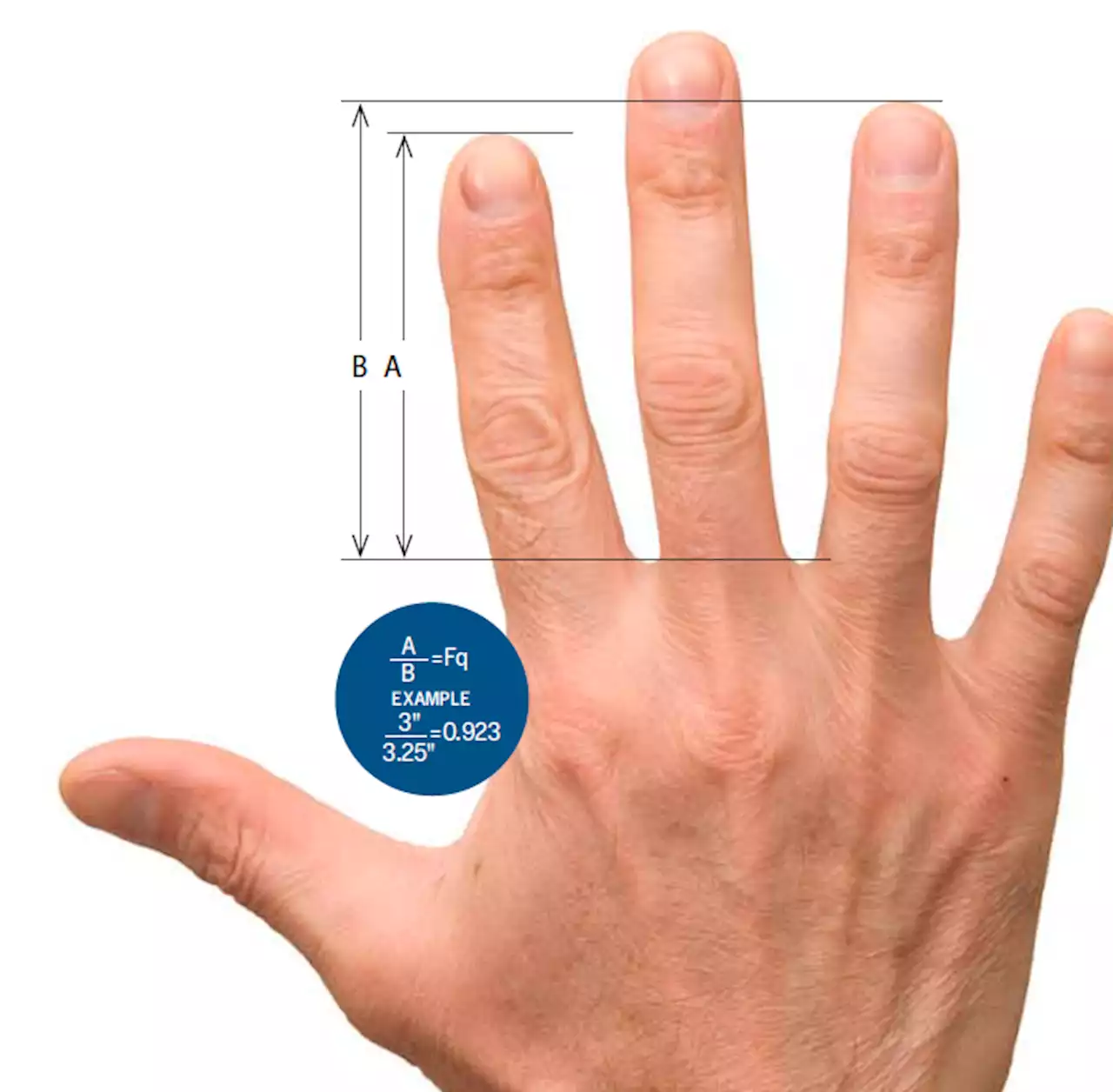 Finger Length Predicts Health and Behavior