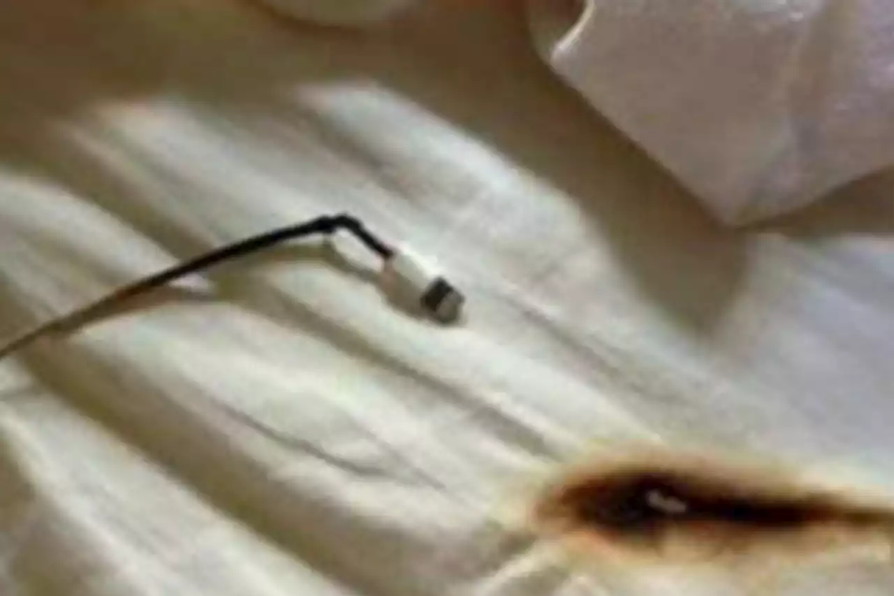 Horror photos show what can happen if you fall asleep with phone charging in bed