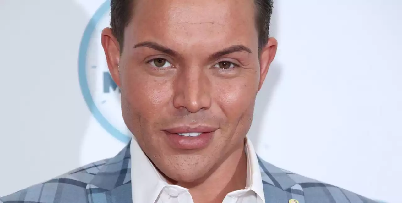 TOWIE's Bobby Norris shares he's had his facial fillers dissolved