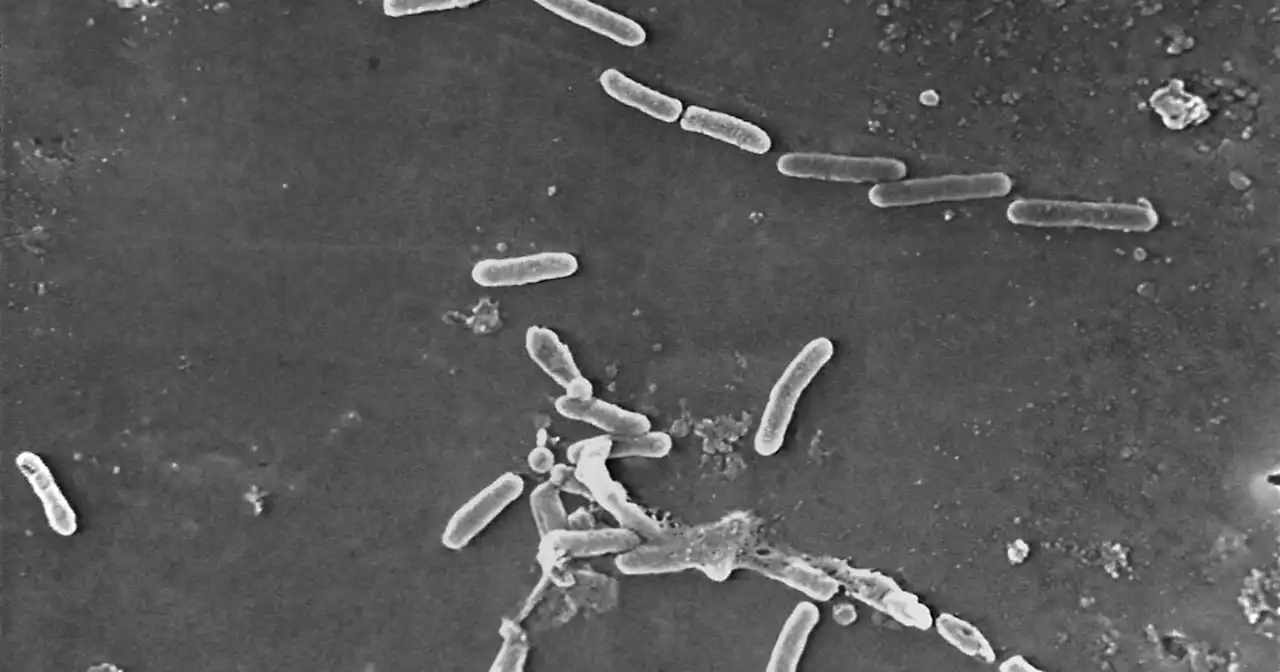 Study: Drug-resistant bacteria kill 1.2 million globally