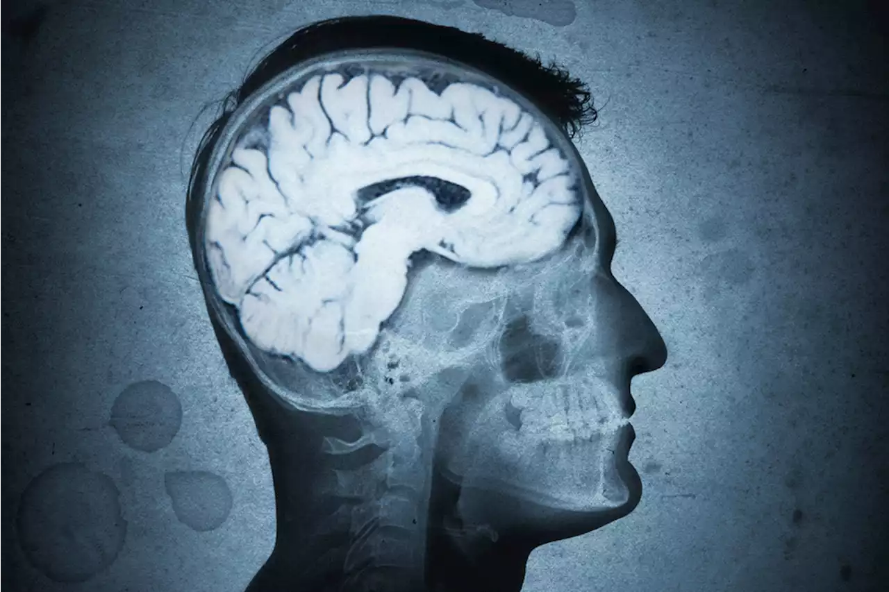 Meet the Parasites That Control Human Brains