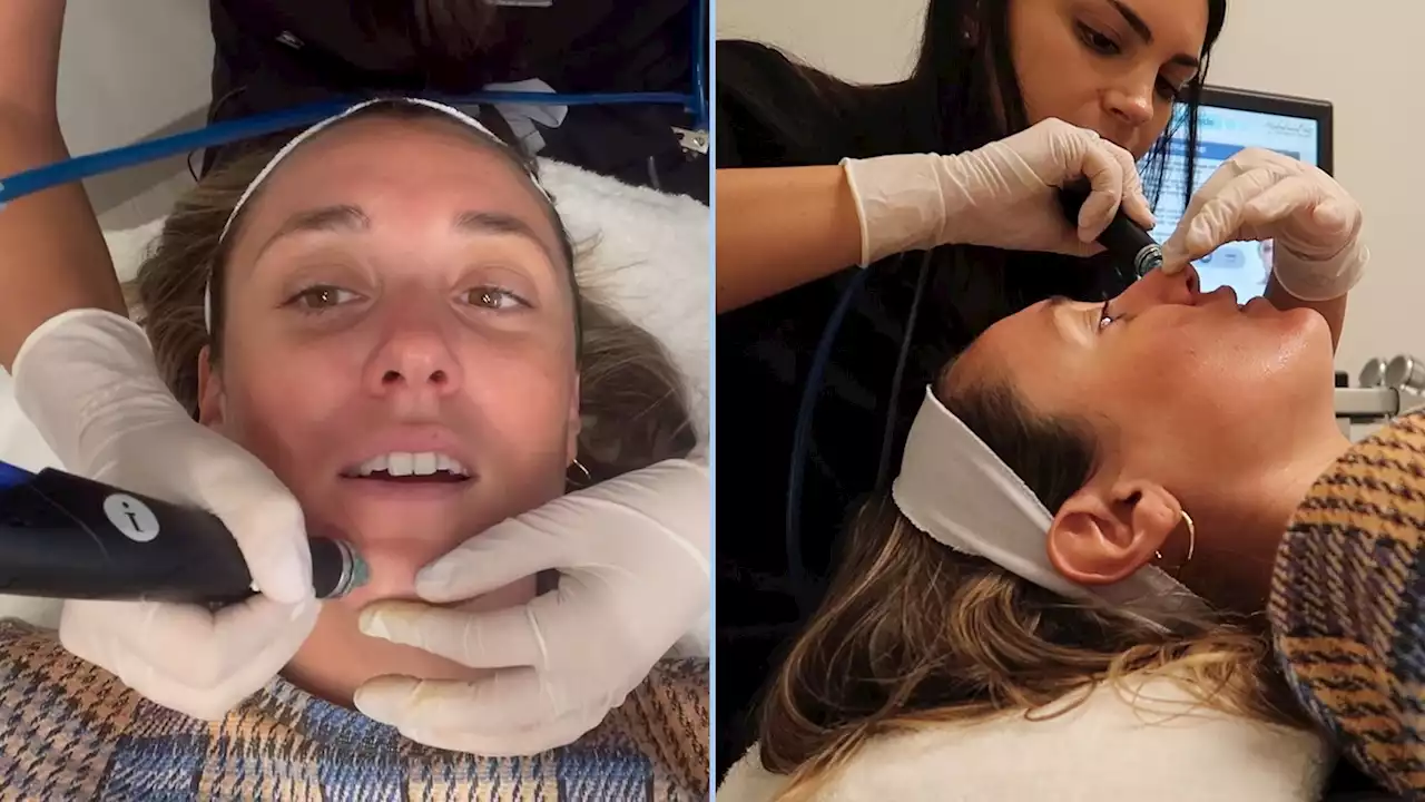 I tried a Hydrafacial and I can't believe what was hiding in my face