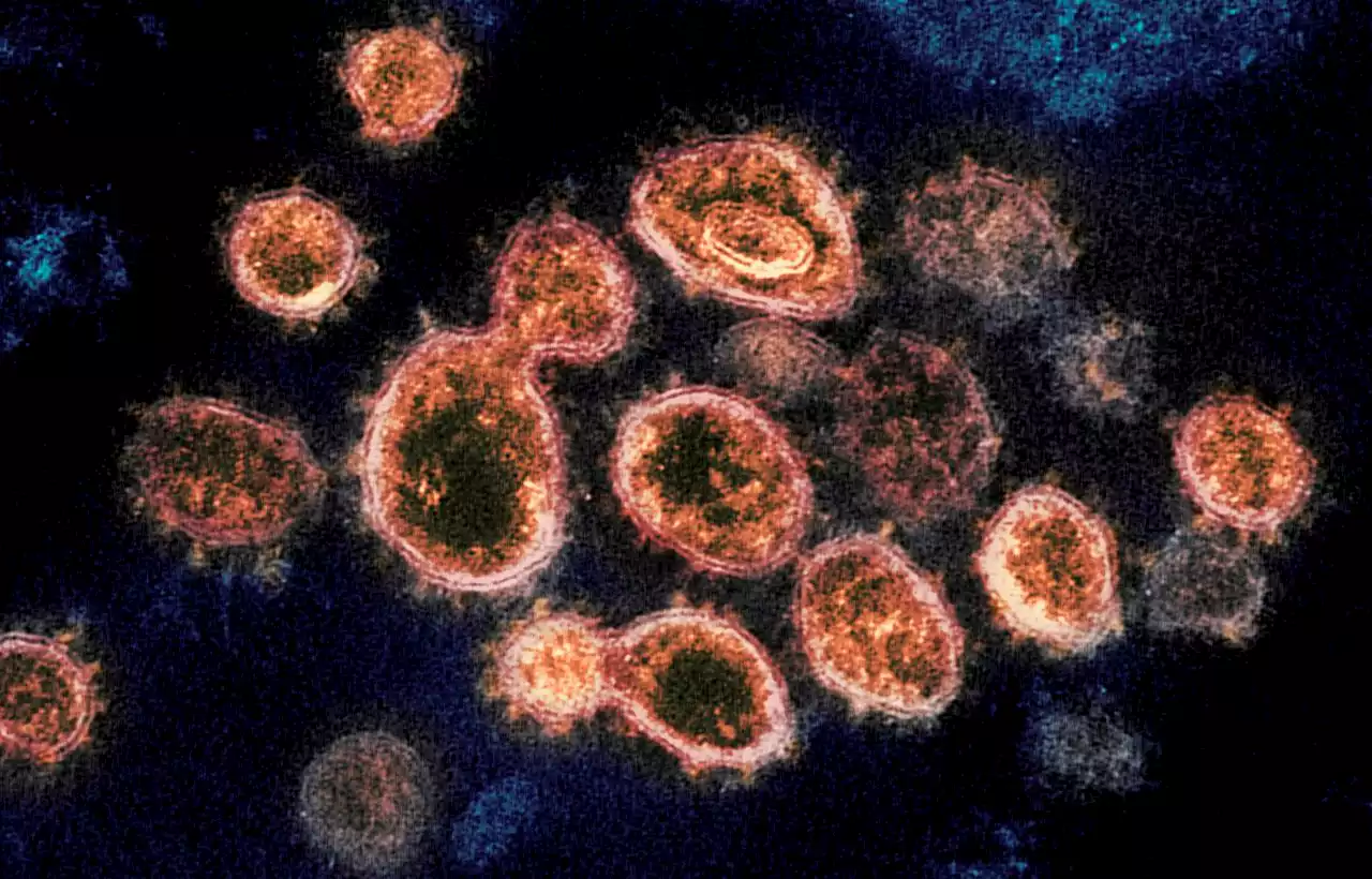 Ohio’s daily COVID-19 case number is 4,163 but incomplete due to data error: daily coronavirus update for Tuesday, Jan. 25