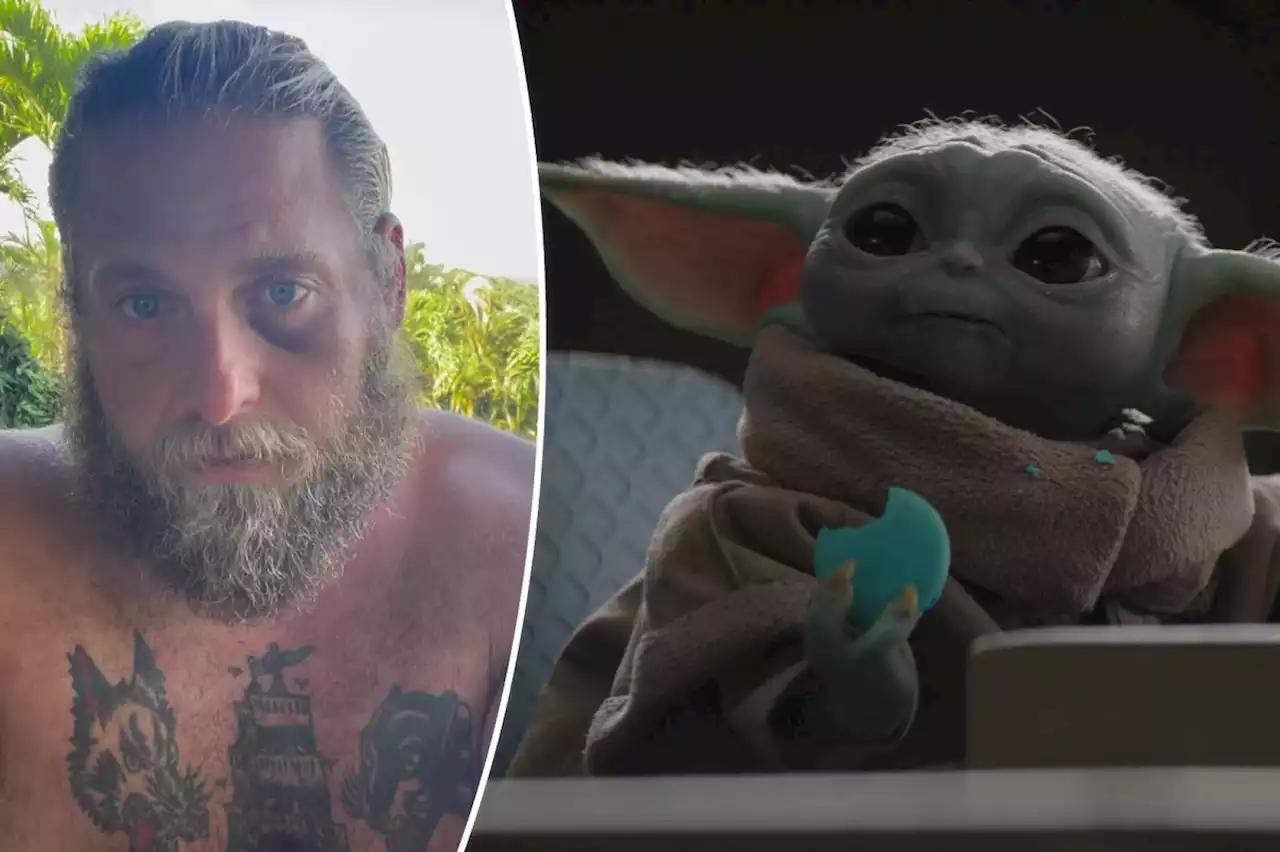 Jonah Hill shows off black eye, escalates ‘feud’ with Baby Yoda