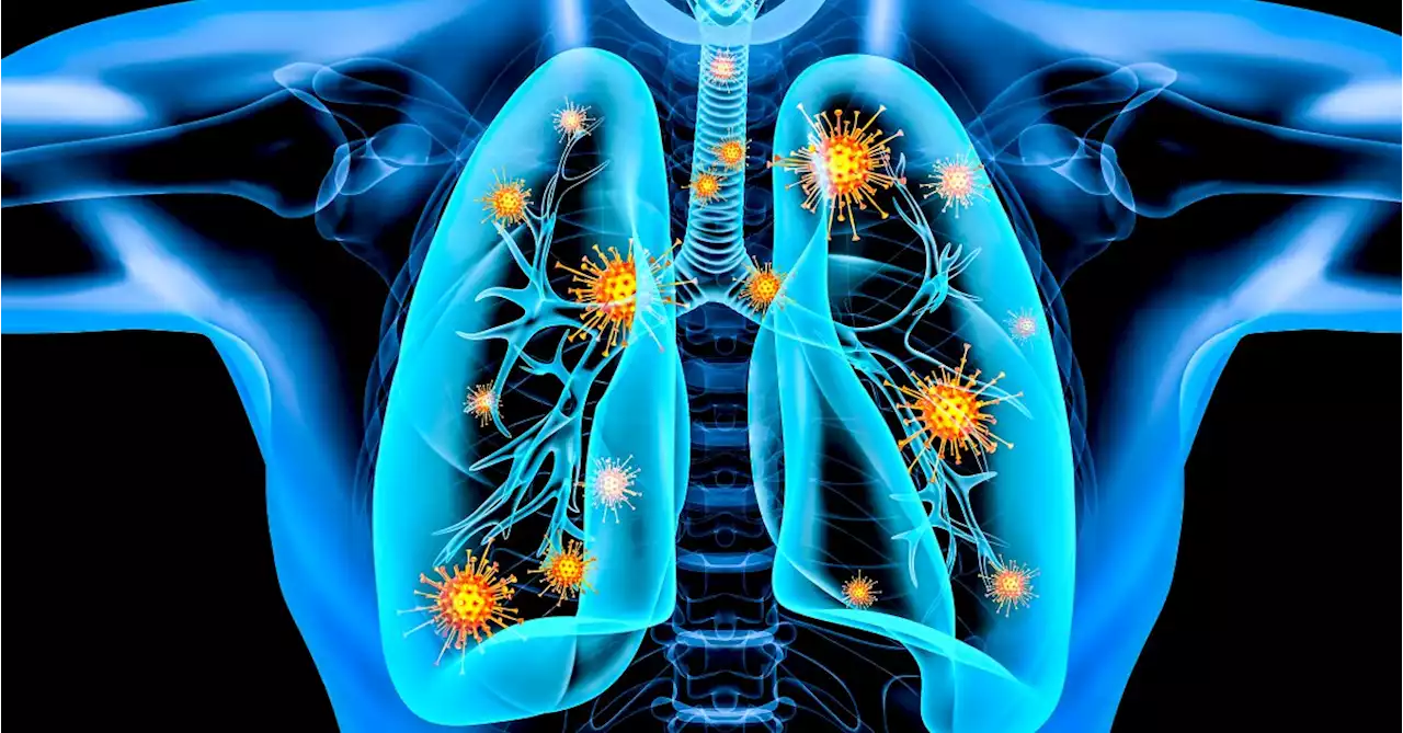 Omicron Variant Appears to Cause Less Damage to Lungs, Studies Say