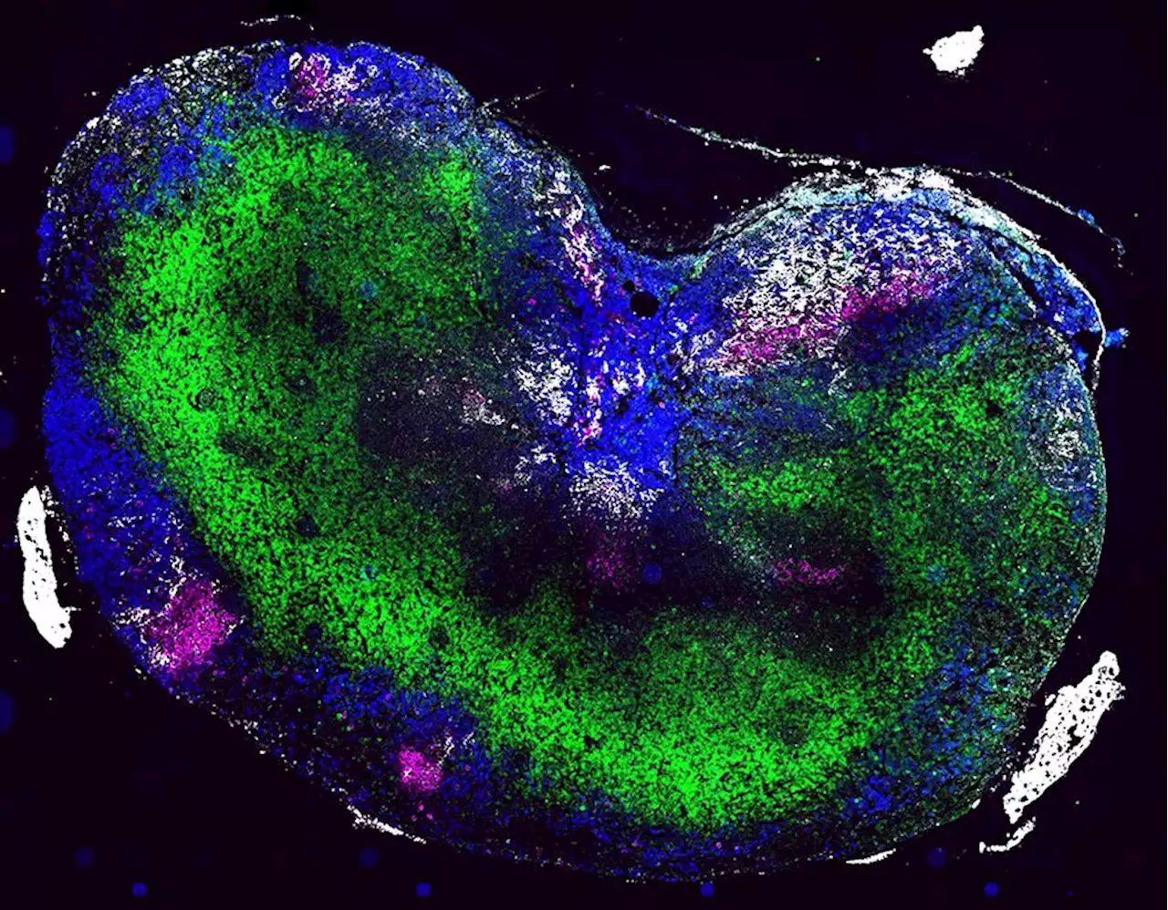 High-affinity, neutralizing antibodies to SARS-CoV-2 can be made without T follicular helper cells