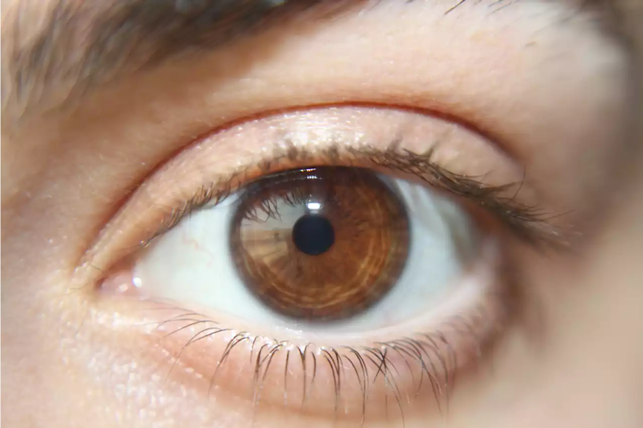 Pupil Size May Be Linked to Intelligence