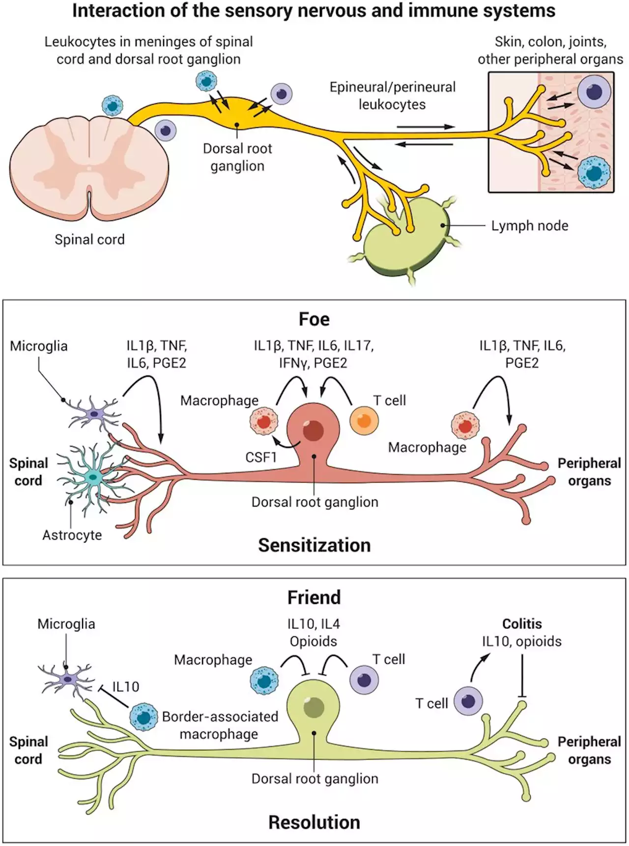 Immune regulation of pain: Friend and foe