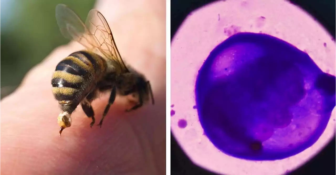 Honeybee Venom Induces 100% Breast Cancer Cell Death