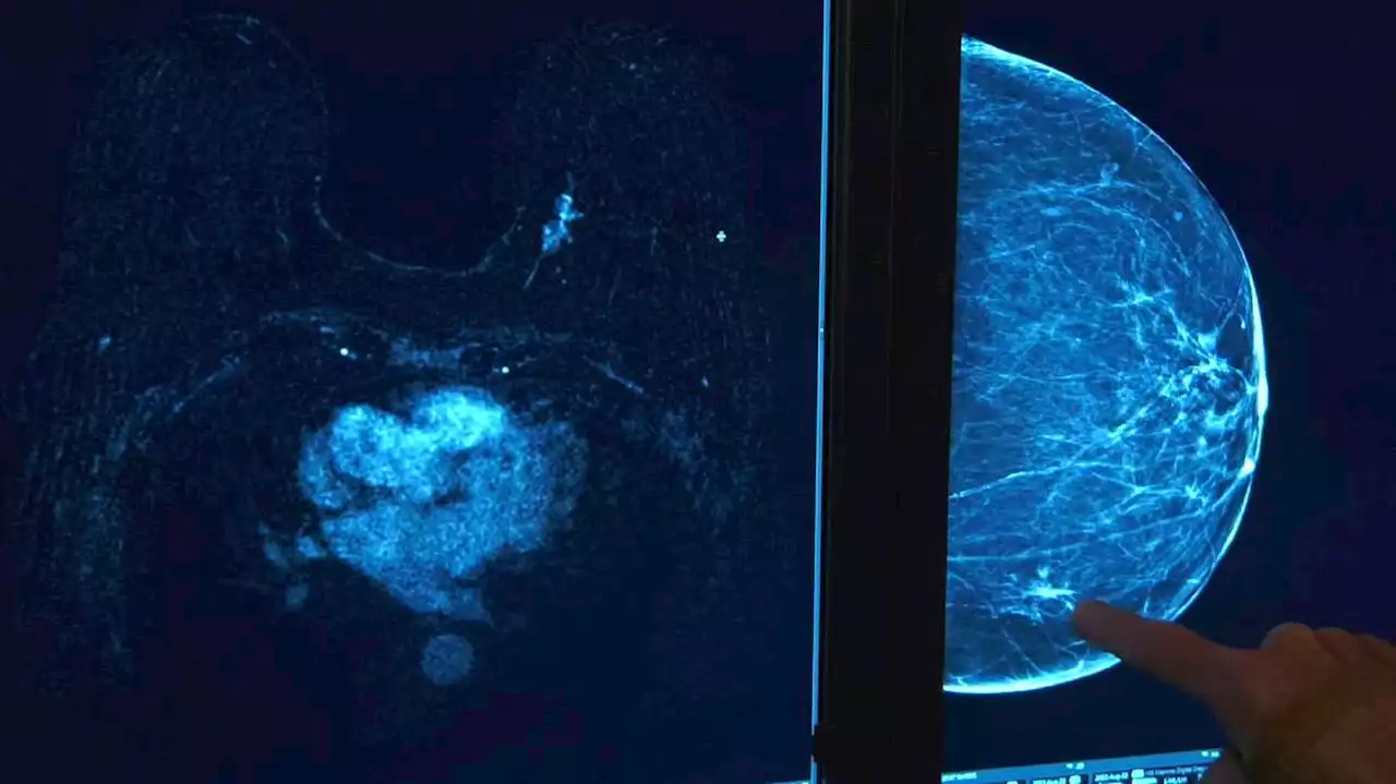 Intermountain Healthcare unveils new imaging tool for breast cancer screening