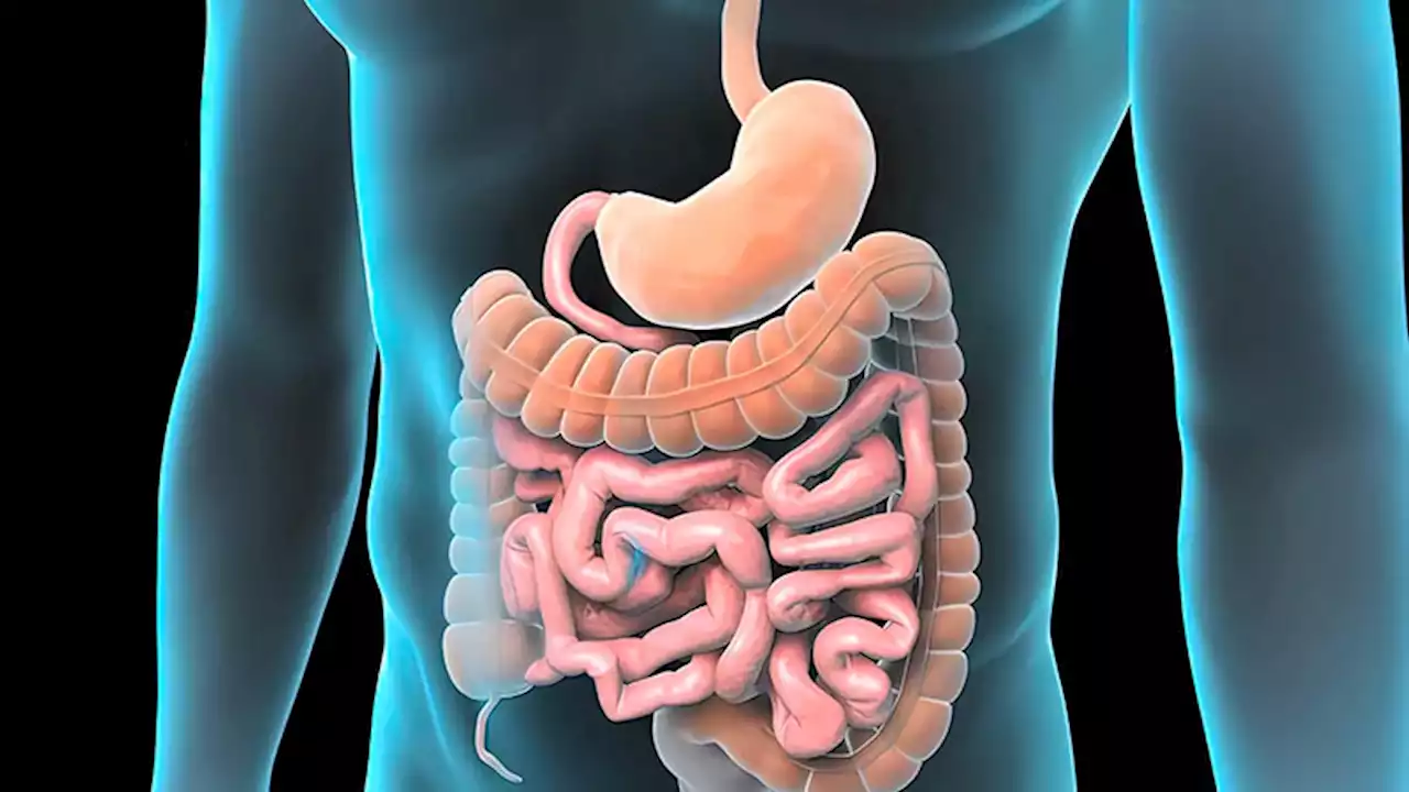 Managing Short Bowel Syndrome: Expert Review