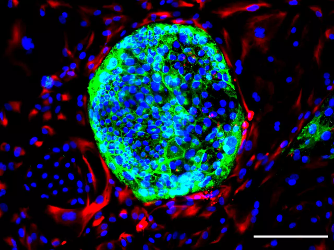 Biologists Create a New Type of Human Cells