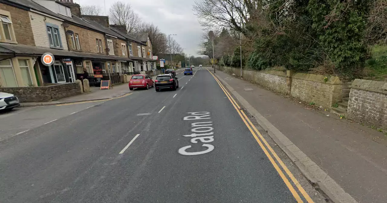 Young man left with fractured eye socket after violent street attack