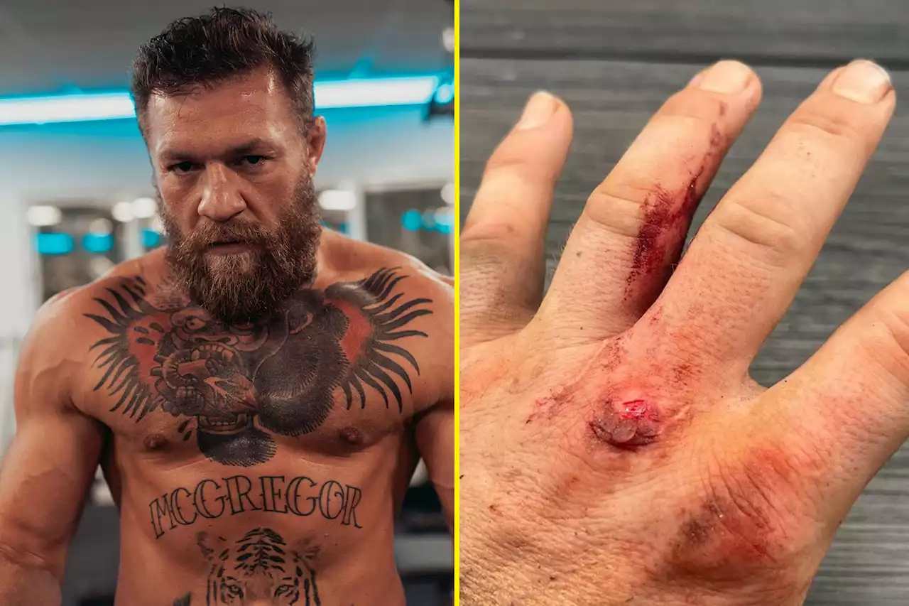 Conor McGregor shows off battered and bloody hand after filming scenes for movie debut