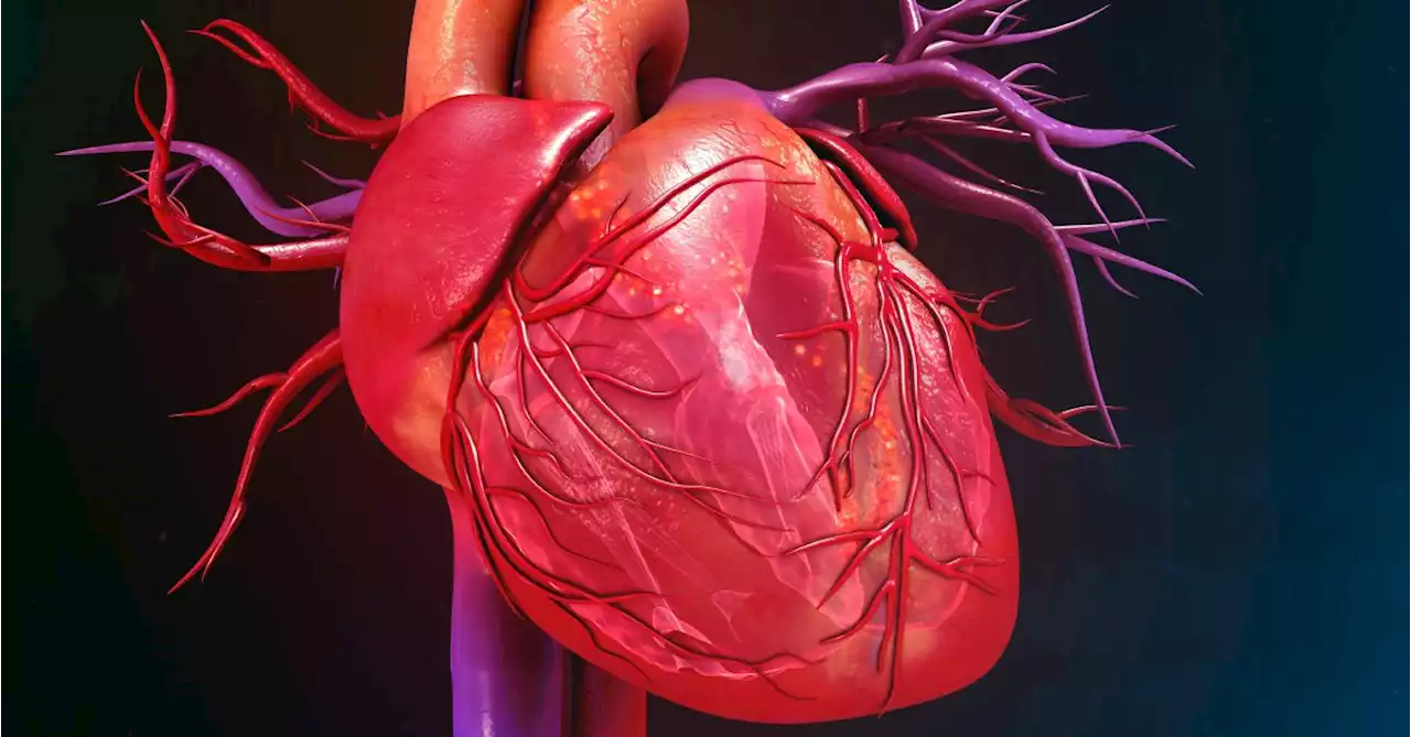 Tetralogy of Fallot