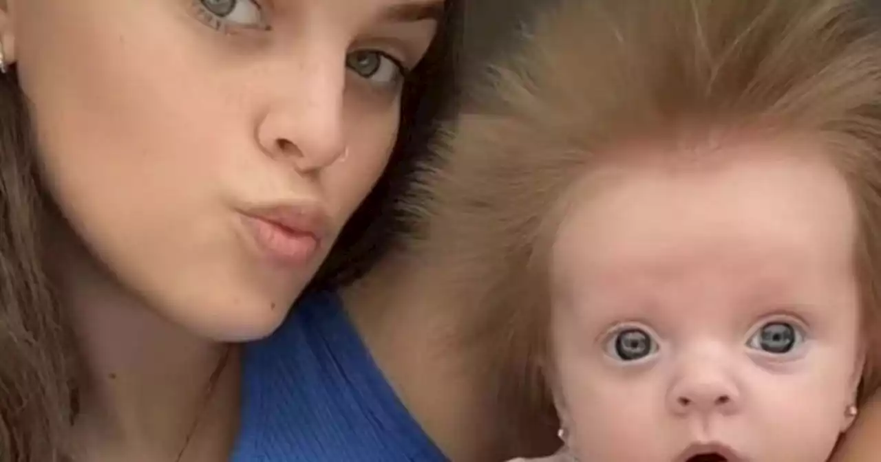 Mum constantly stopped in street over baby's 'crazy' hair that 'won't stay down'