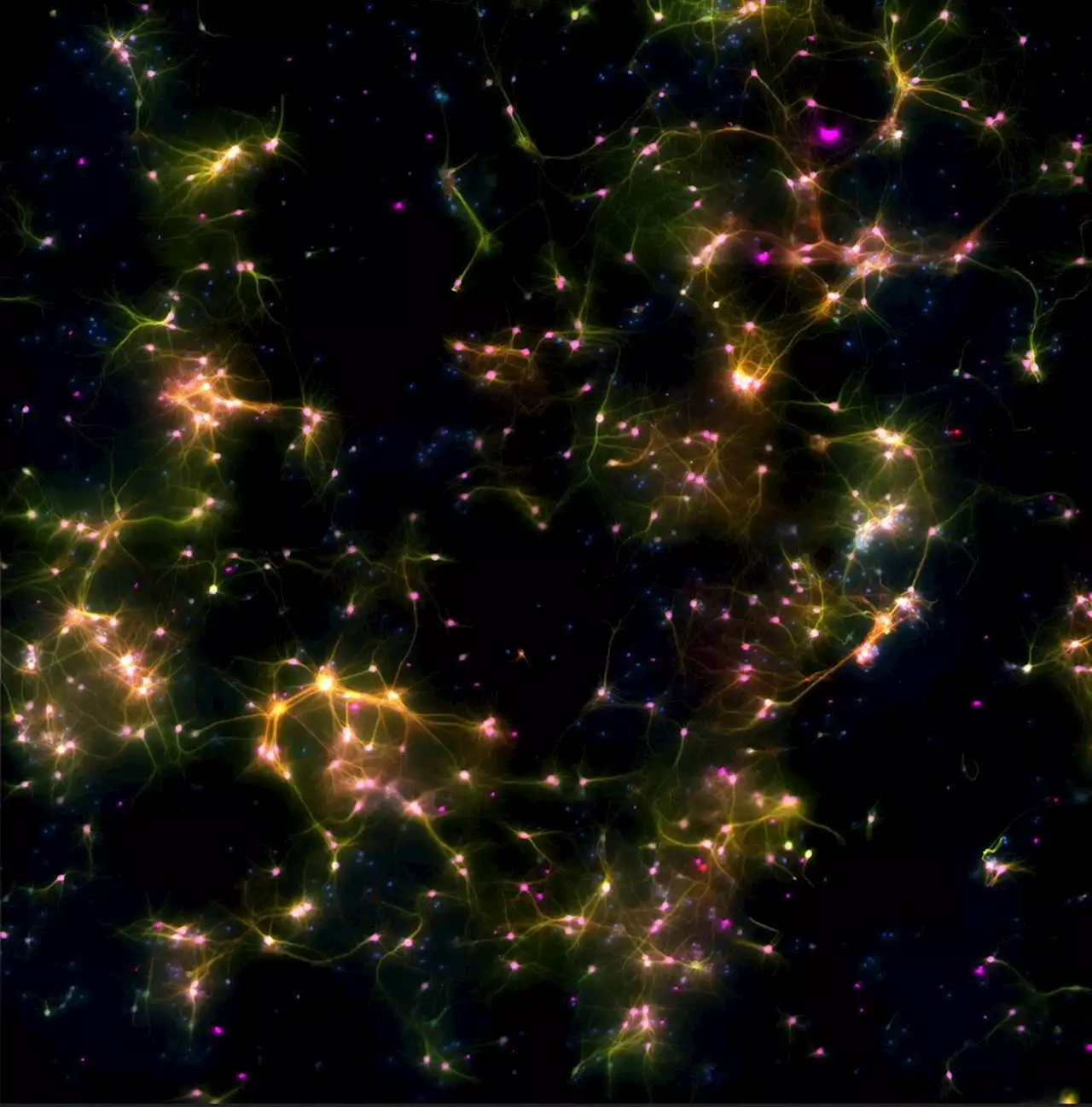 Watch brain cells in a dish learn to play Pong in real time