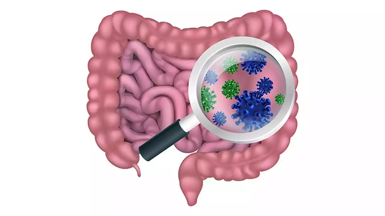 Gut Microbiota Disruption a Driver of Aggression in Schizophrenia?