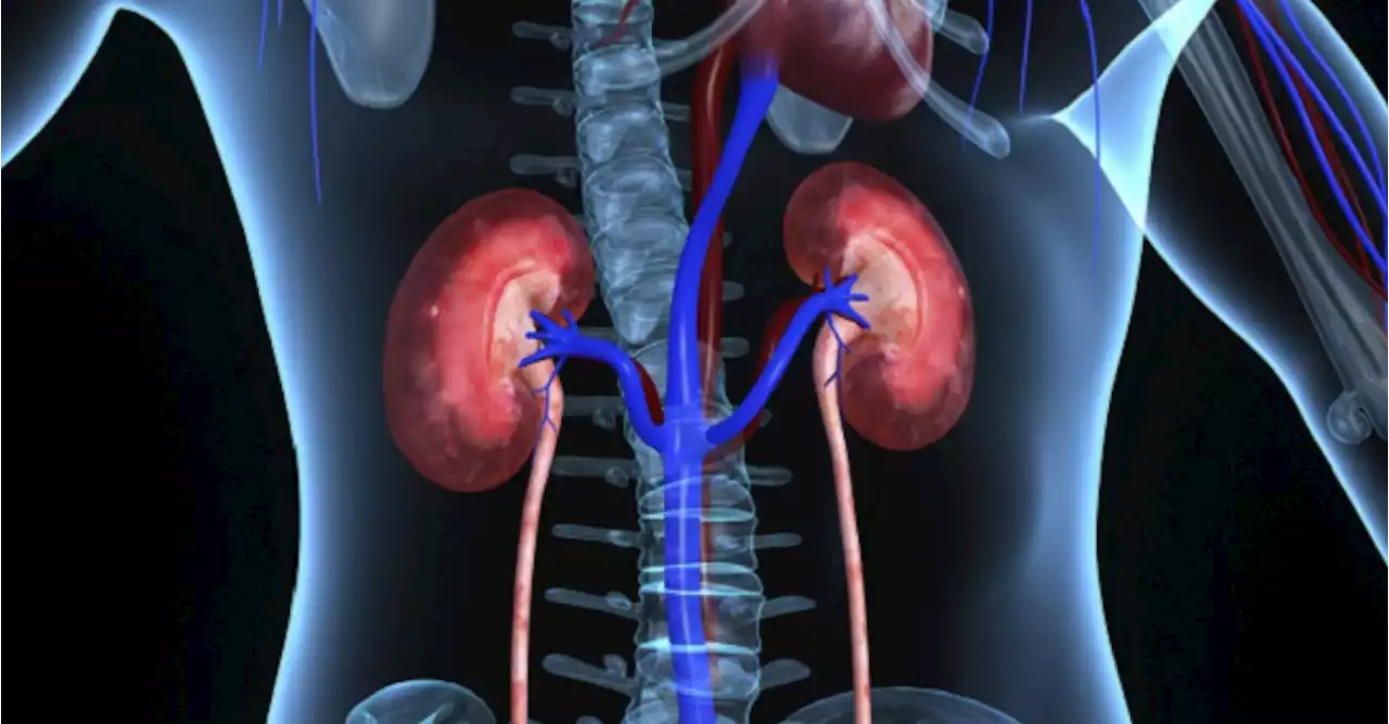 Anemia Increases as Kidney Disease Worsens; Iron Levels Overlooked