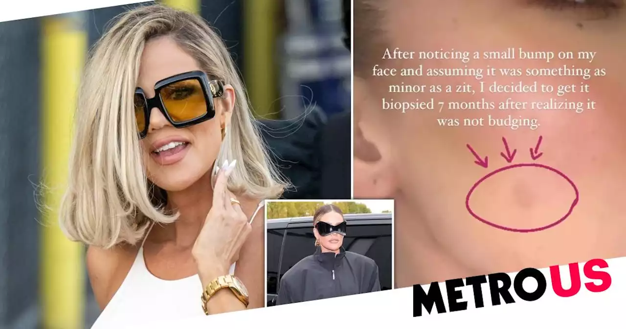 Khloe Kardashian has tumour removed from face amid skin cancer scare