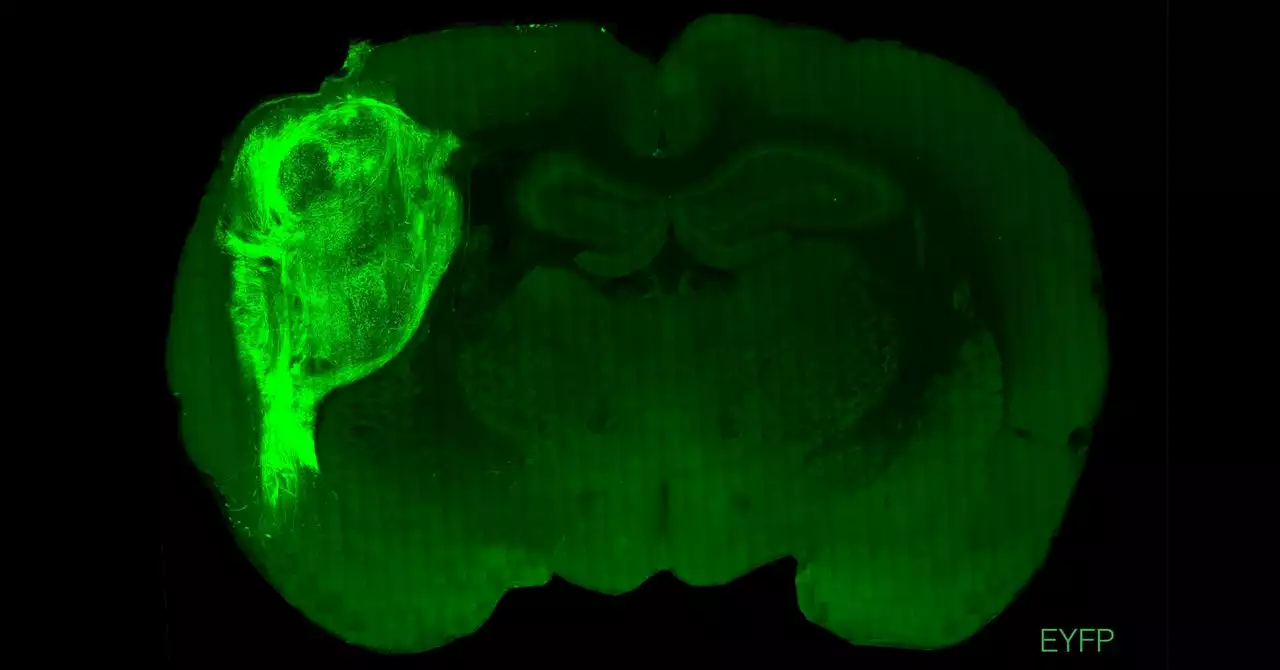 Lab-Grown Human Brain Tissue Works in Rats