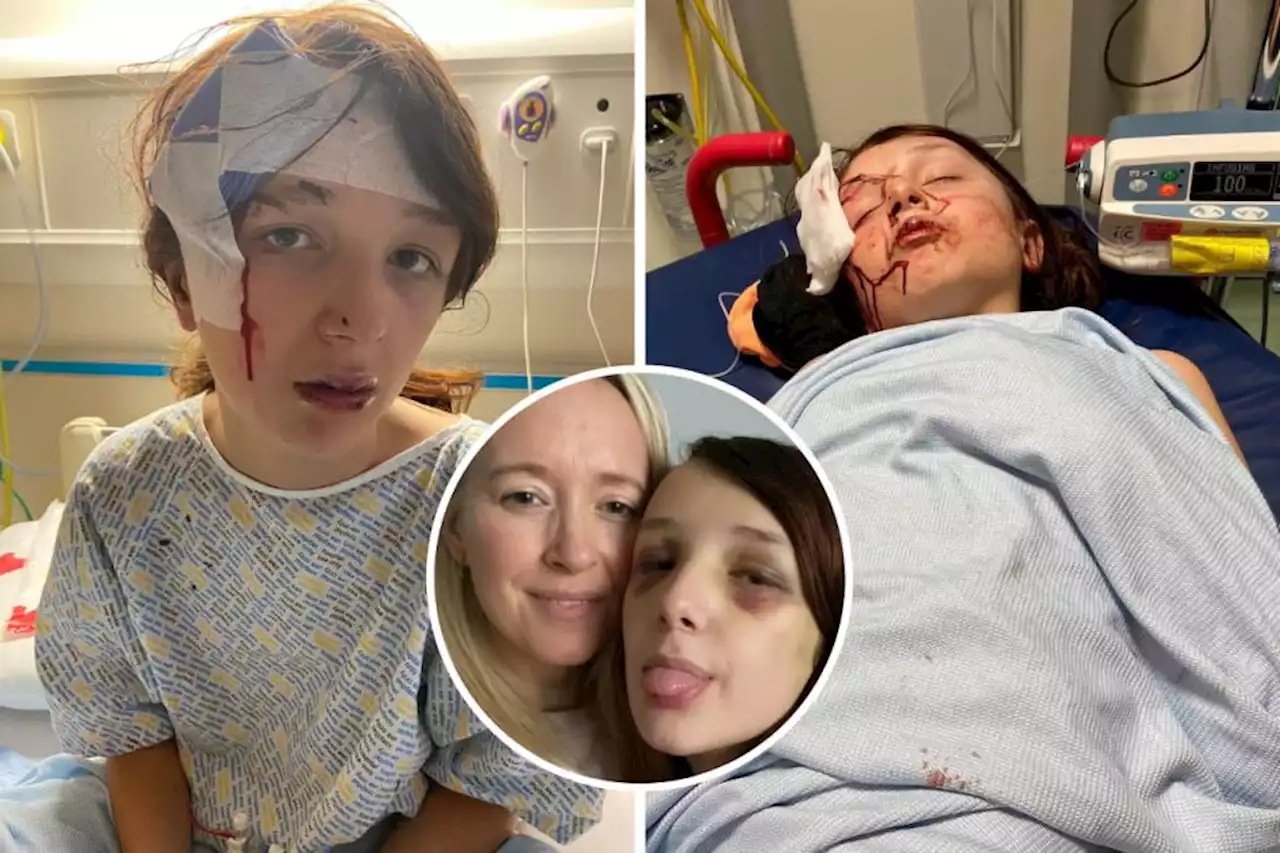 'She's petrified': Mum of autistic schoolgirl speaks out after 'attack' at Glasgow park