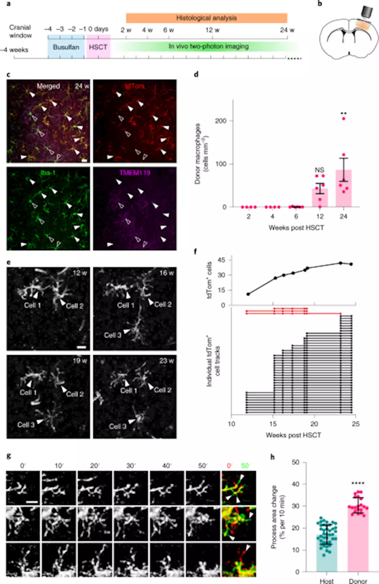 Hematopoietic stem cell transplantation chemotherapy causes microglia senescence and peripheral macrophage engraftment in the brain - Nature Medicine