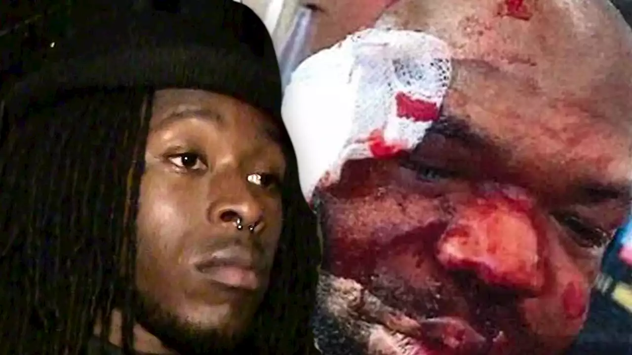 Alvin Kamara Sued Over Alleged Vegas Beatdown, Man Seeking $10 Million