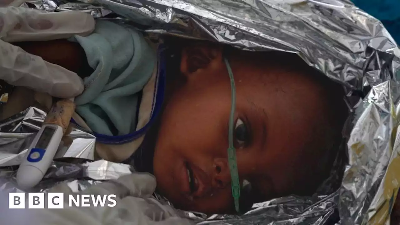 Somalia drought: The moment a two-year-old dies from hunger