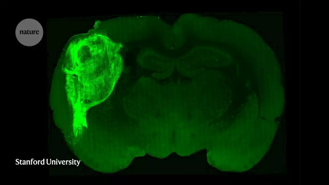 Human brain cells implanted in rats prompt excitement — and concern