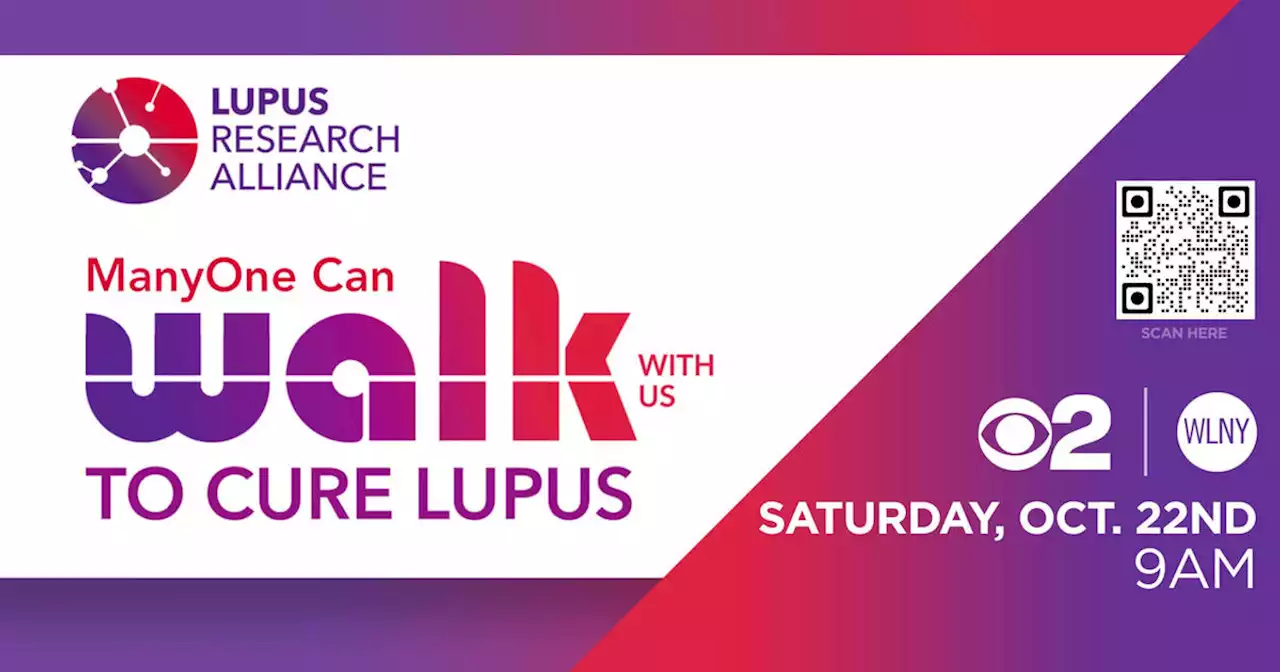 Local woman shares her lupus journey ahead of Walk with Us to Cure Lupus this weekend