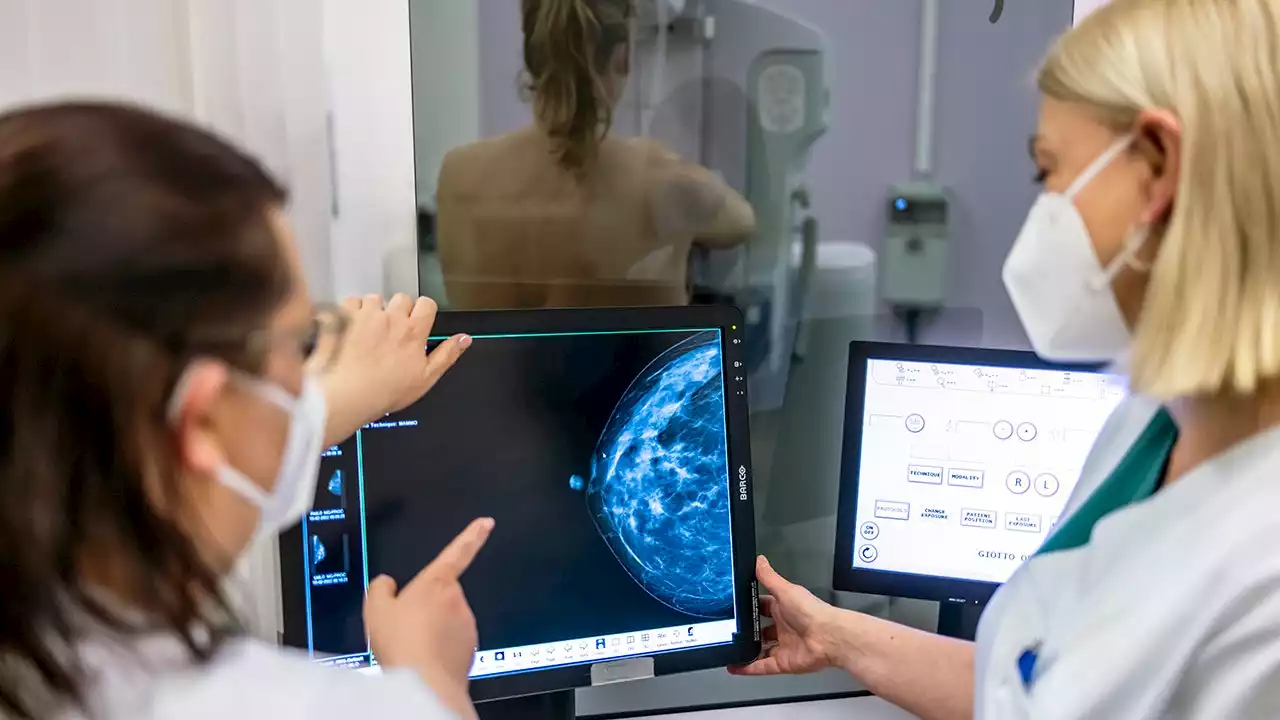 Breast cancer survivors at Fox push to make mammograms more accessible to American women