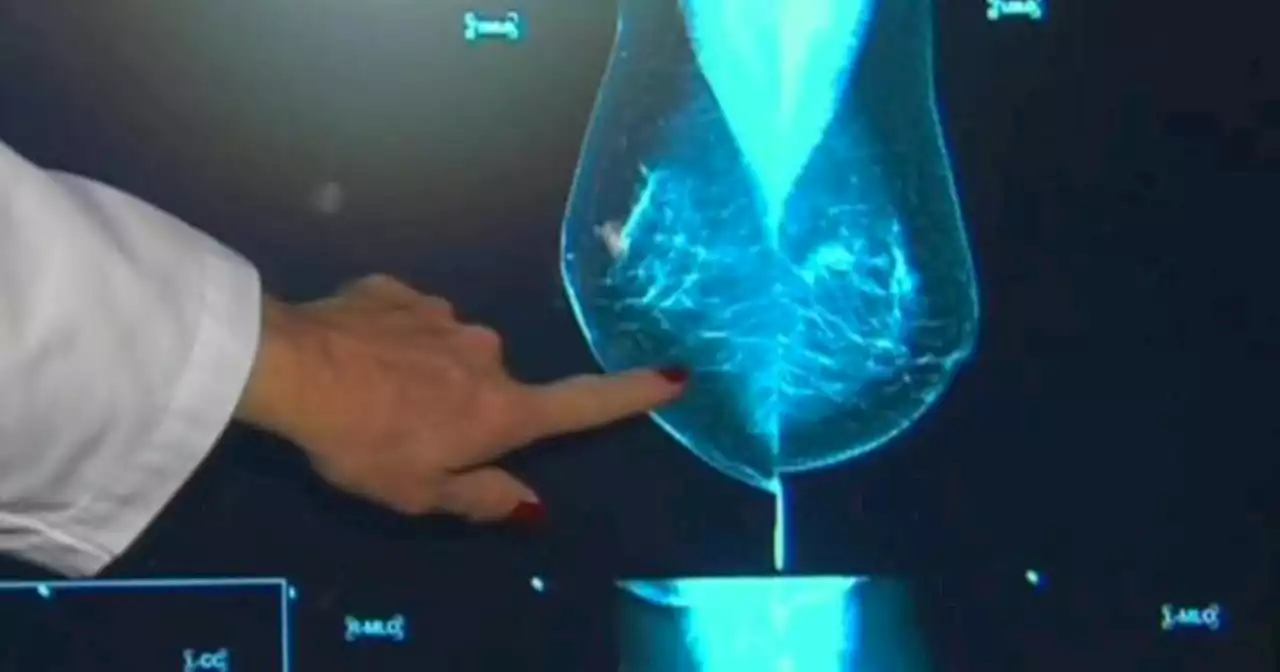 FDA plans new regulations on mammograms in effort to help women with dense breasts