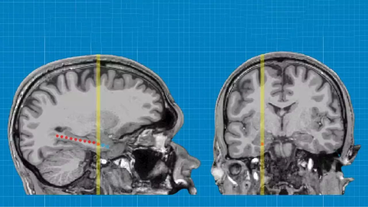 Researchers looked deep inside the brain to see how memory is stored