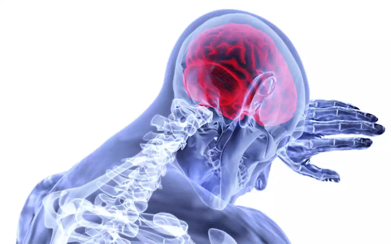 Ahead of World Stroke Day, South Africans urged to lead healthier lifestyles