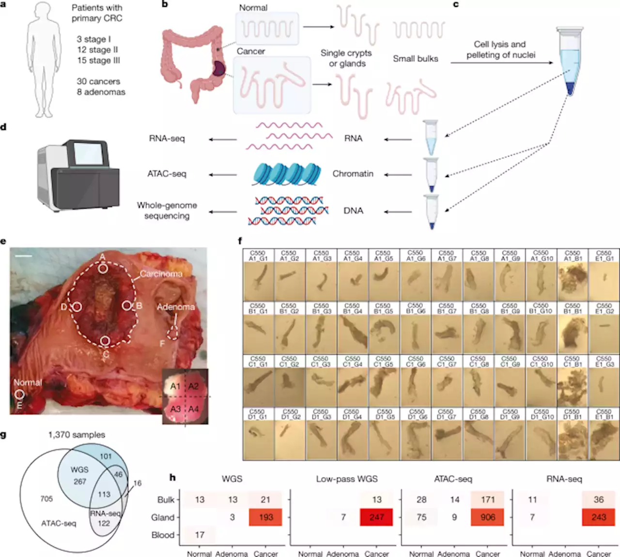 The co-evolution of the genome and epigenome in colorectal cancer - Nature