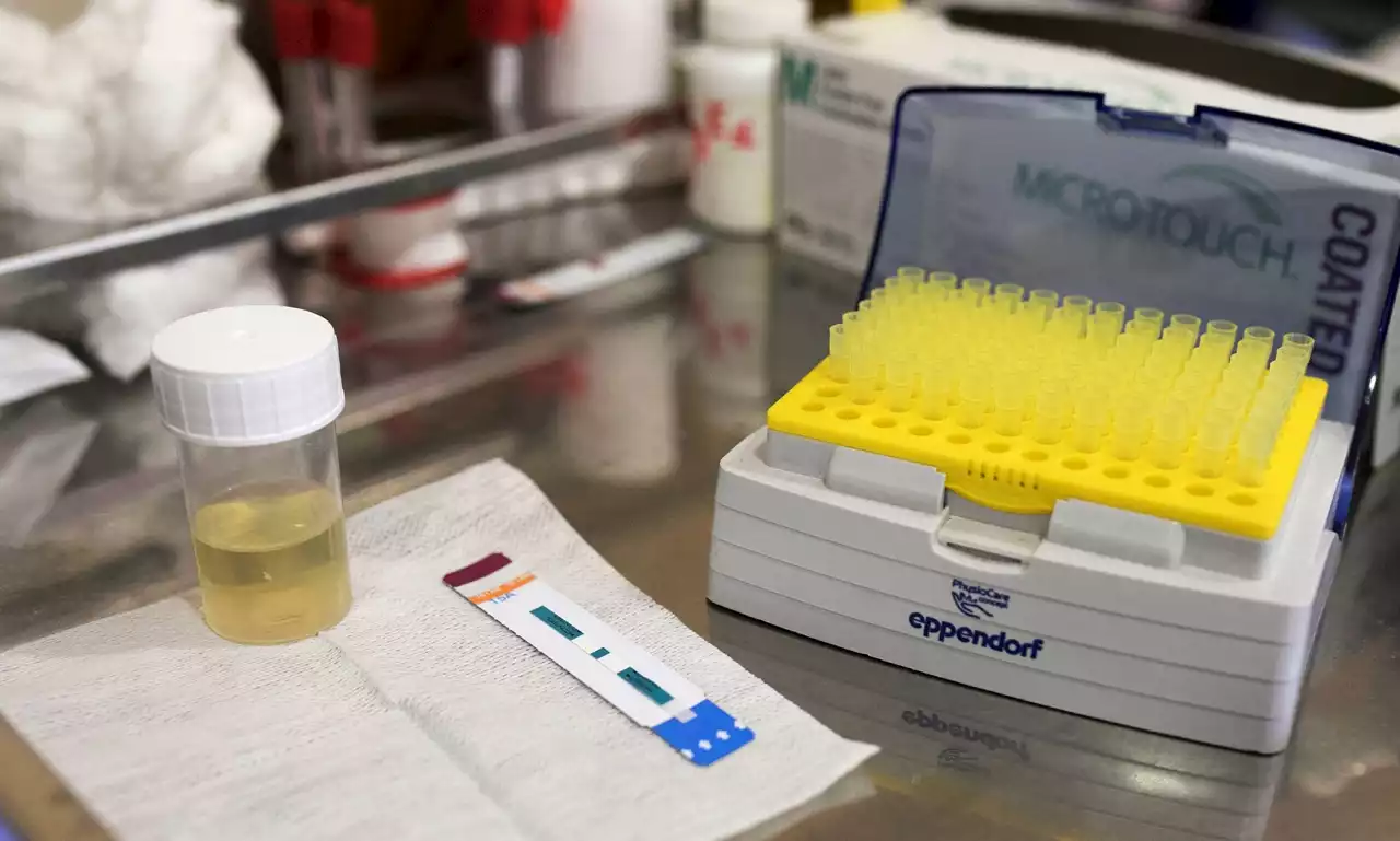 SPOTLIGHT IN-DEPTH: After slow start, uptake for urine TB test is picking up