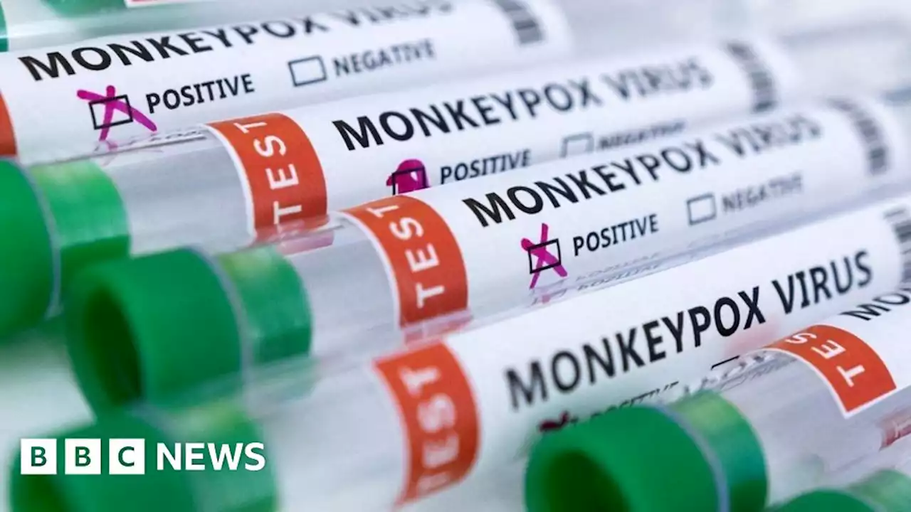 UK looks to be winning the fight against monkeypox